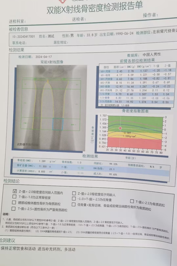 雙能X射線骨密度儀:準確測量骨密度,助力骨質疏松防治,守護骨骼健康 雙能X射線骨密度儀:準確測量骨密度,助力骨質疏松防治,守護骨骼健康